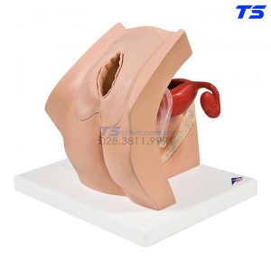 Mô Hình Thực Hành Đặt Và Tháo Dụng Cụ Tử Cung - 1013705 - 3B