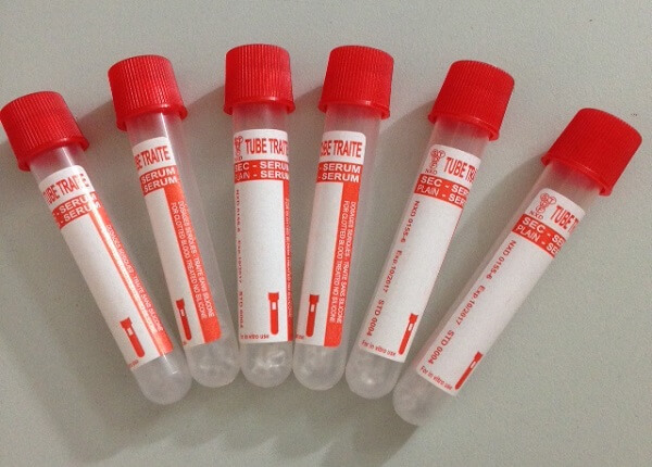 Ống nghiệm Serum