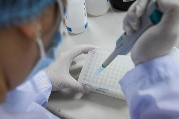 Tổng quan về test kit